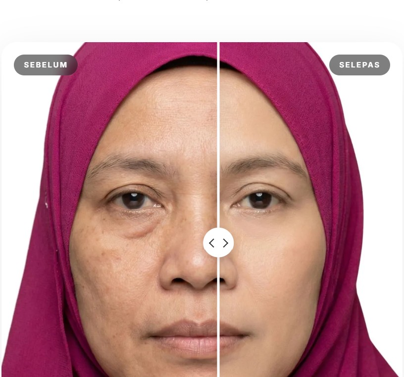 Perbandingan visual kulit sebelum dan selepas penggunaan rutin penjagaan Nadeen